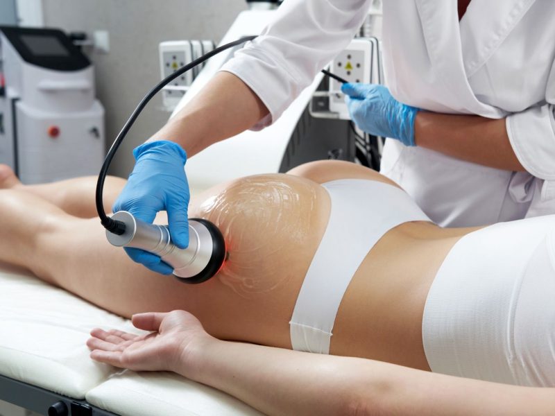 Crioterapia Corporal  (Tratamientos reductor o reafirmante)