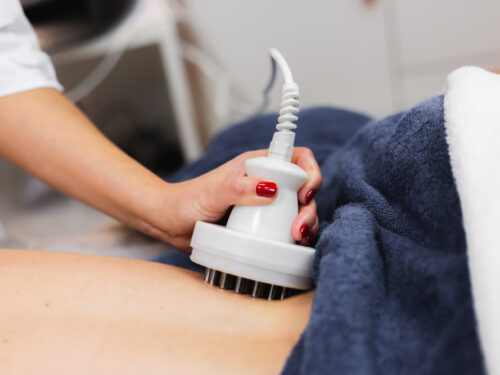 Radiofrecuencia Corporal